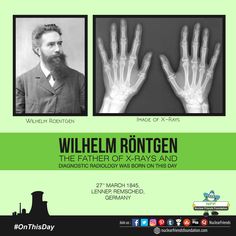 Wilhelm Rontgen