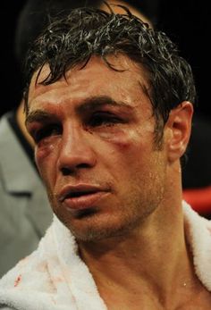 Michael Katsidis