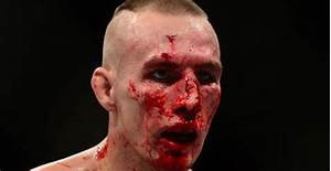 Rory Macdonald