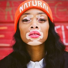 Winnie Harlow