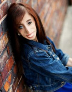 Lizzie Velasquez