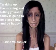 Lizzie Velasquez