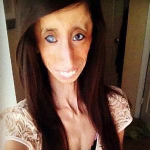 Lizzie Velasquez