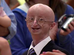 Sam Berns