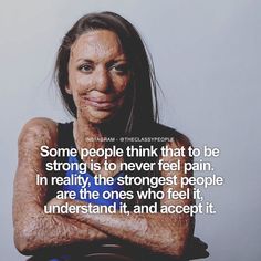 Turia Pitt