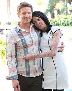 Turia Pitt