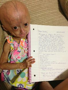 Adalia Rose