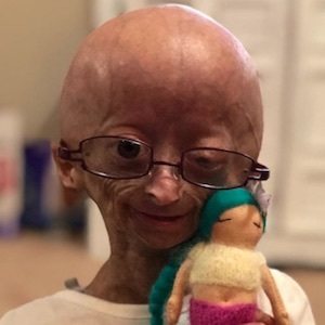 Adalia Rose